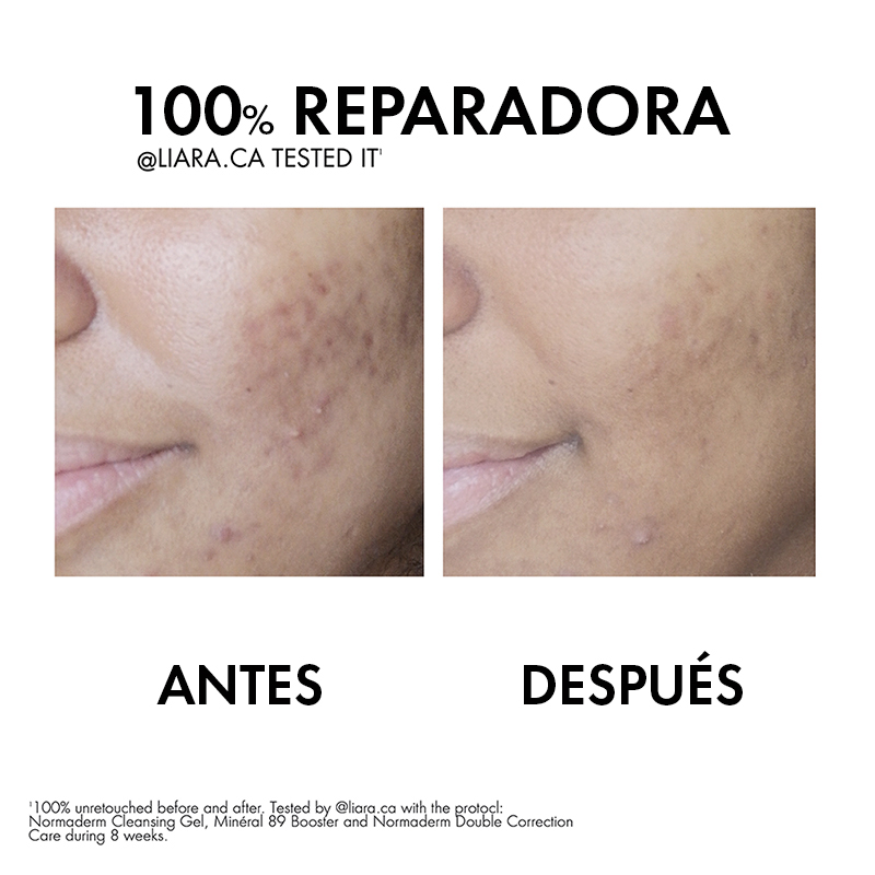 Vichy Normaderm Cuidado Diario Doble Corrección 50ml - Dermaproductos Guatemala