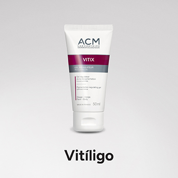 Vitíligo ACM