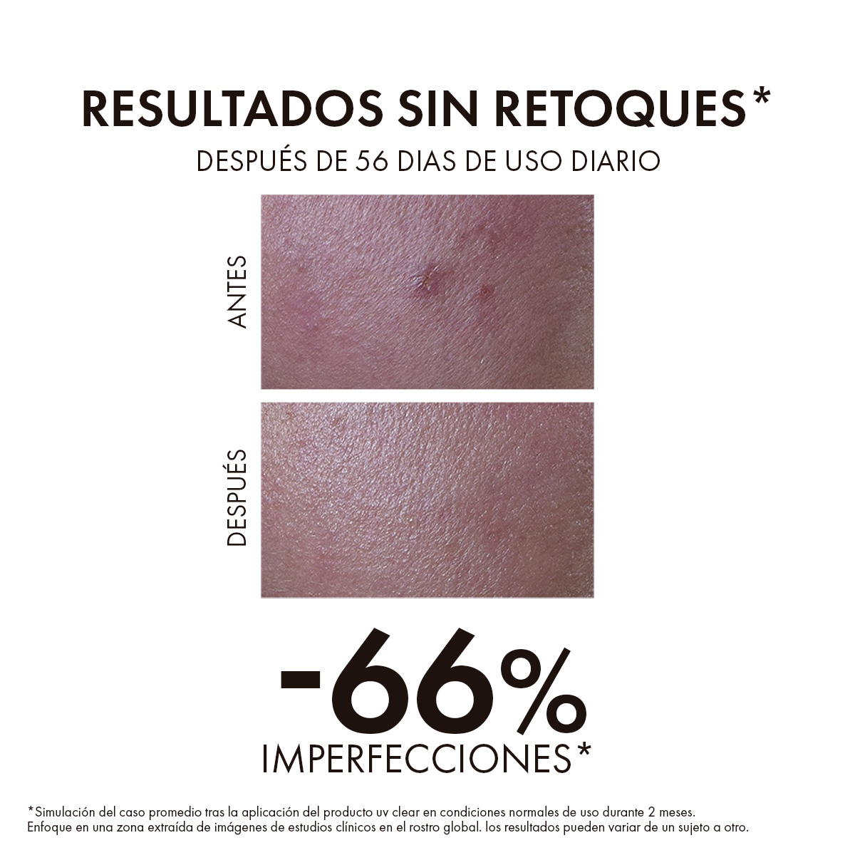 Vichy Capital Soleil UV Clear SPF 50+ Protector Solar 40ml - Dermaproductos Guatemala