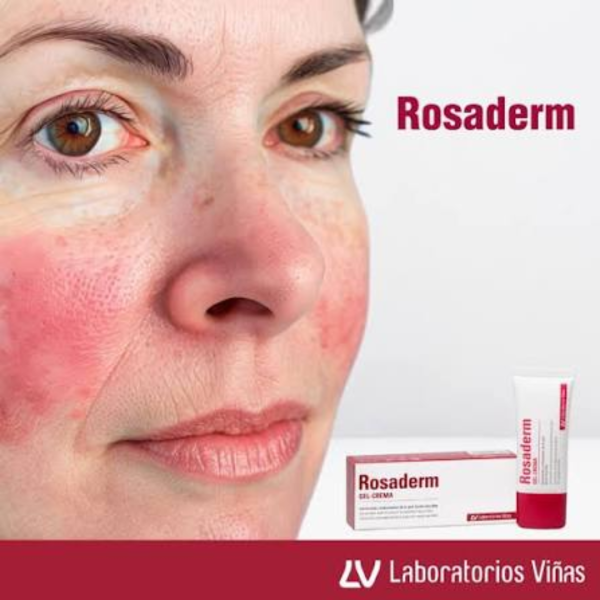 Viñas Rosaderm Gel-Crema 30ml